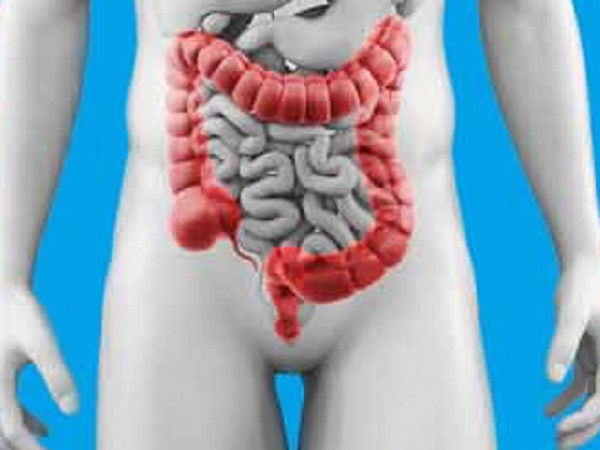 Colorectal Cancer Screening thumbnail